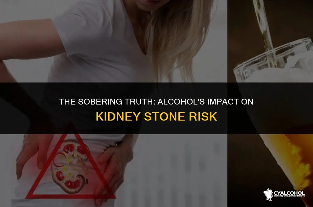 does alcohol worsen kidney stones