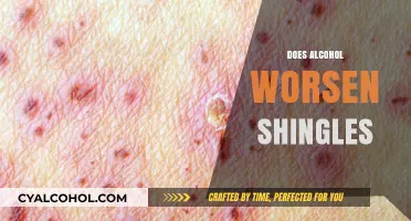 Alcohol and Shingles: Understanding the Impact on Symptoms and Recovery