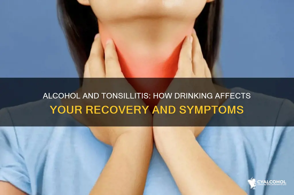 does alcohol worsen tonsillitis