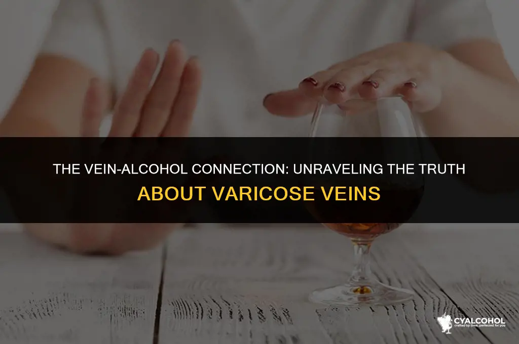 does alcohol worsen varicose veins