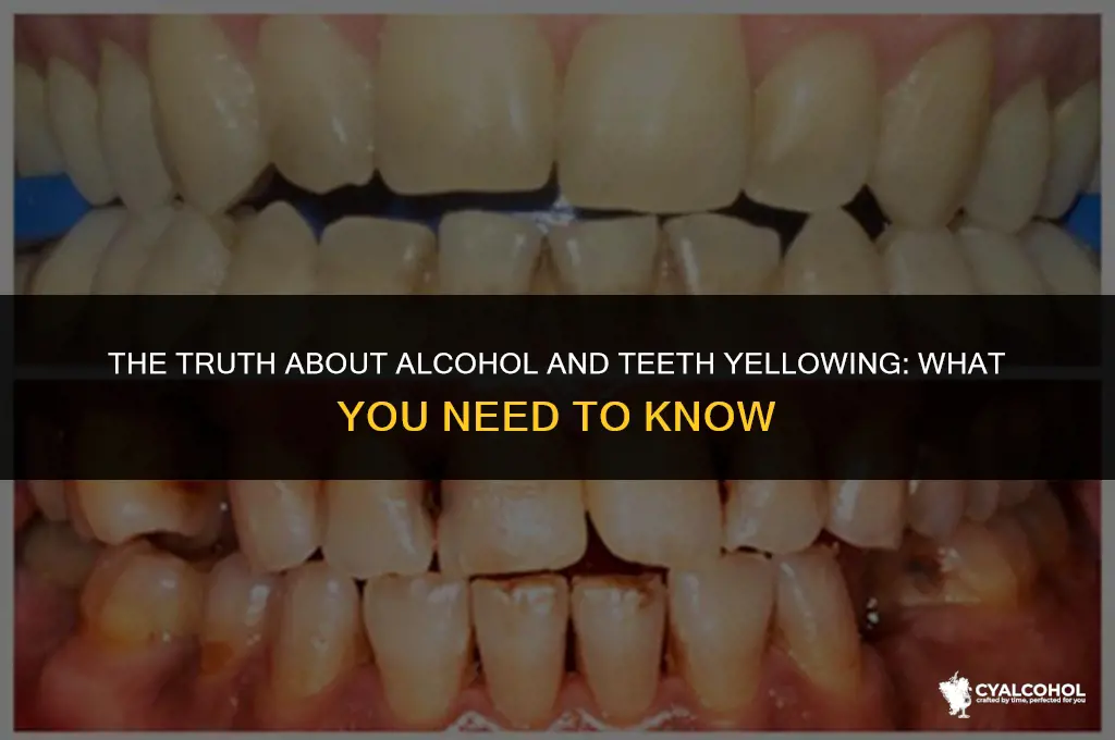 does alcohol yellow your teeth