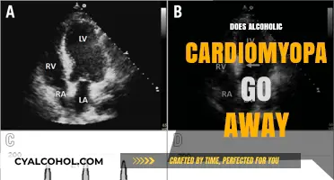 Reversing the Damage: Can Alcoholic Cardiomyopathy Be Cured?