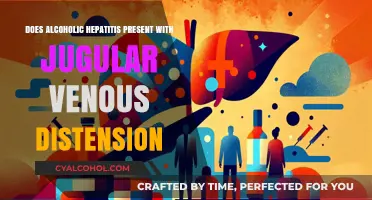 Alcoholic Hepatitis and Jugular Venous Distension: Exploring the Connection