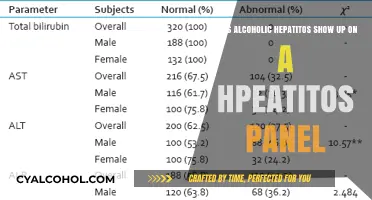 Hepatitis and Hepatic Panels: What Alcoholic Hepatitis Reveals