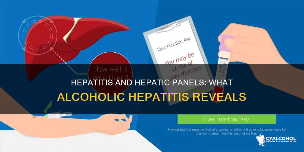does alcoholic hepatitos show up on a hpeatitos panel