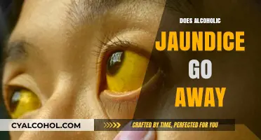 Understanding Alcoholic Jaundice: Causes, Symptoms, and Recovery