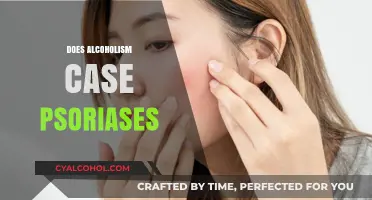 Alcoholism and Psoriasis: Unraveling the Link Between Drinking and Skin Health