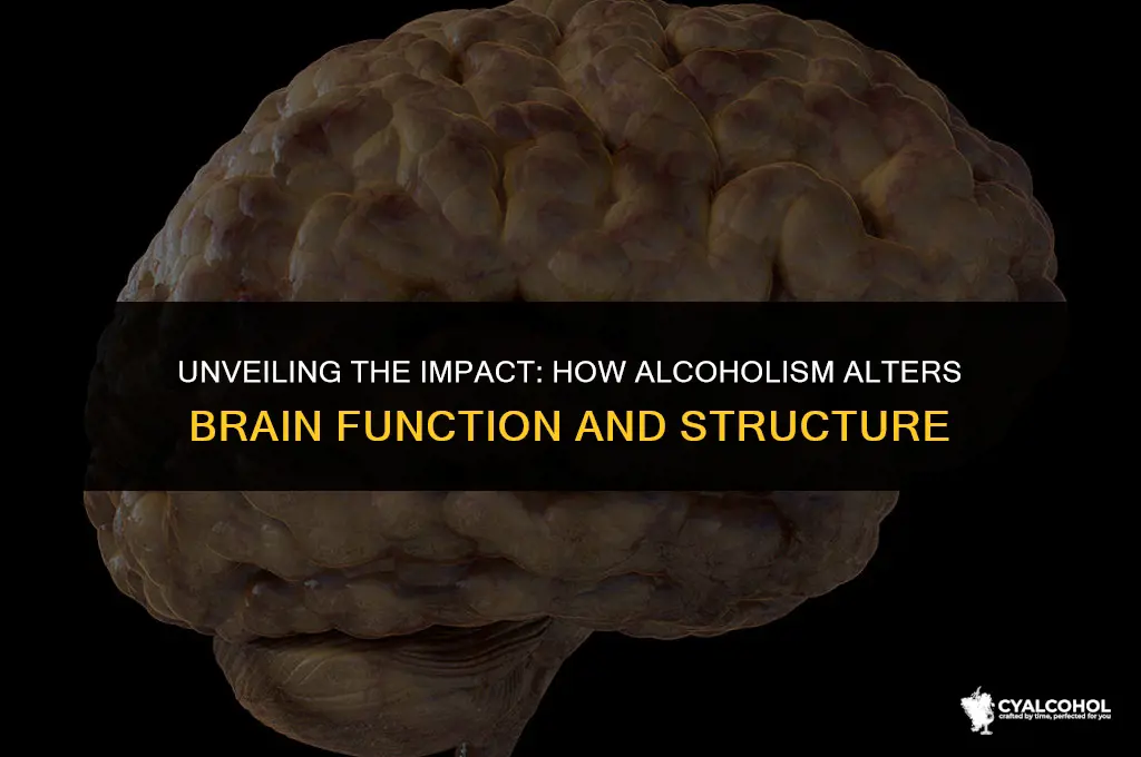does alcoholism change your brain