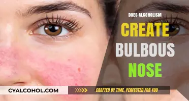 Unveiling the Truth: Alcoholism and the Myth of the Bulbous Nose