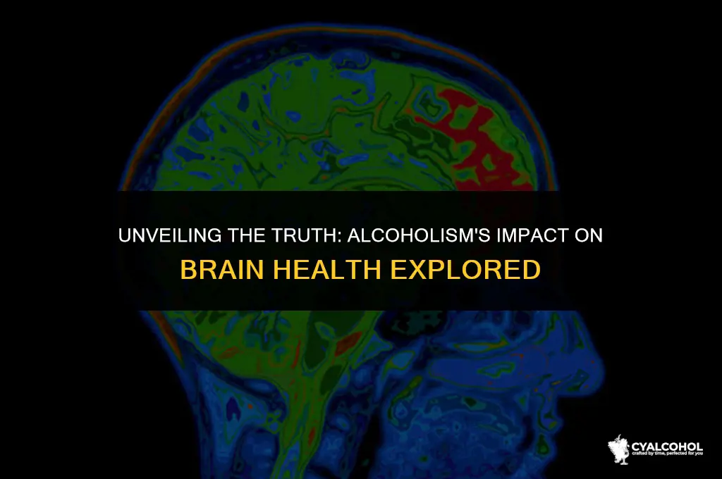 does alcoholism damage the brain