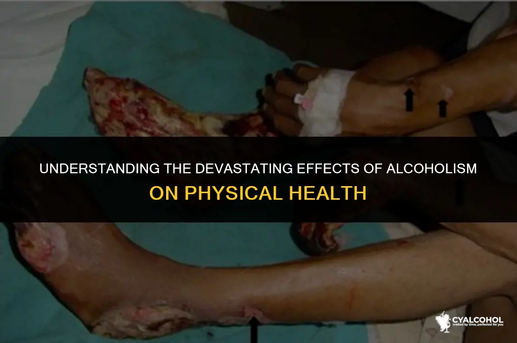 does alcoholism loss of legs