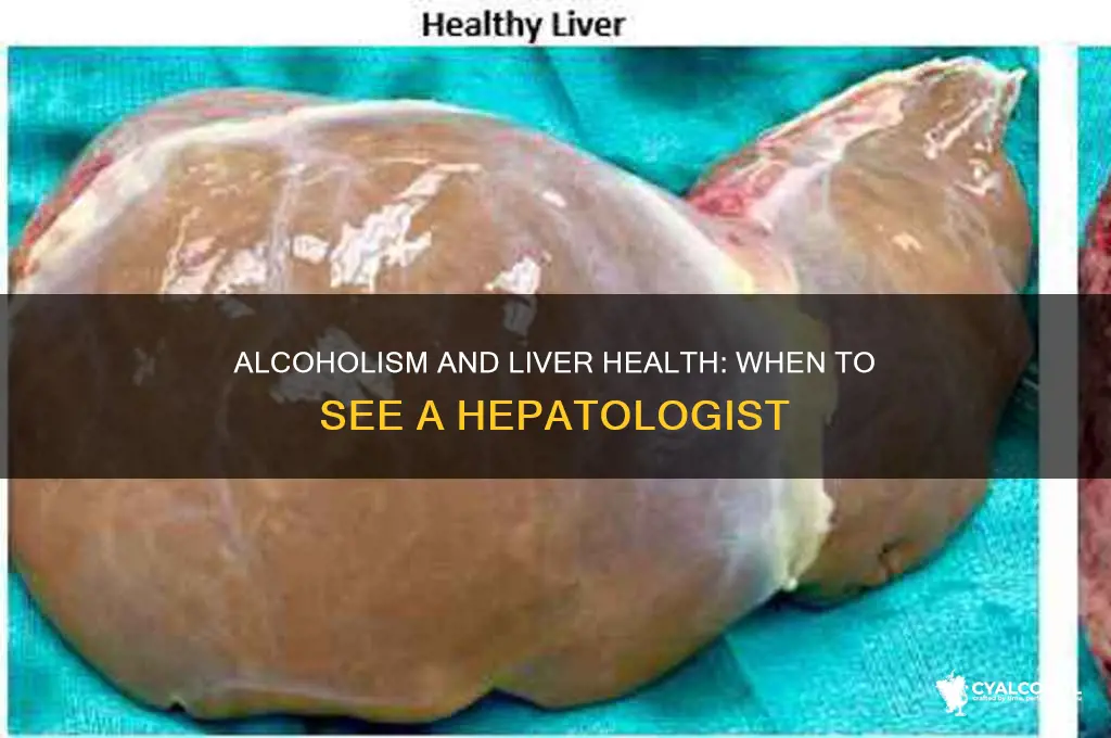 does an alcoholic go to hepatology