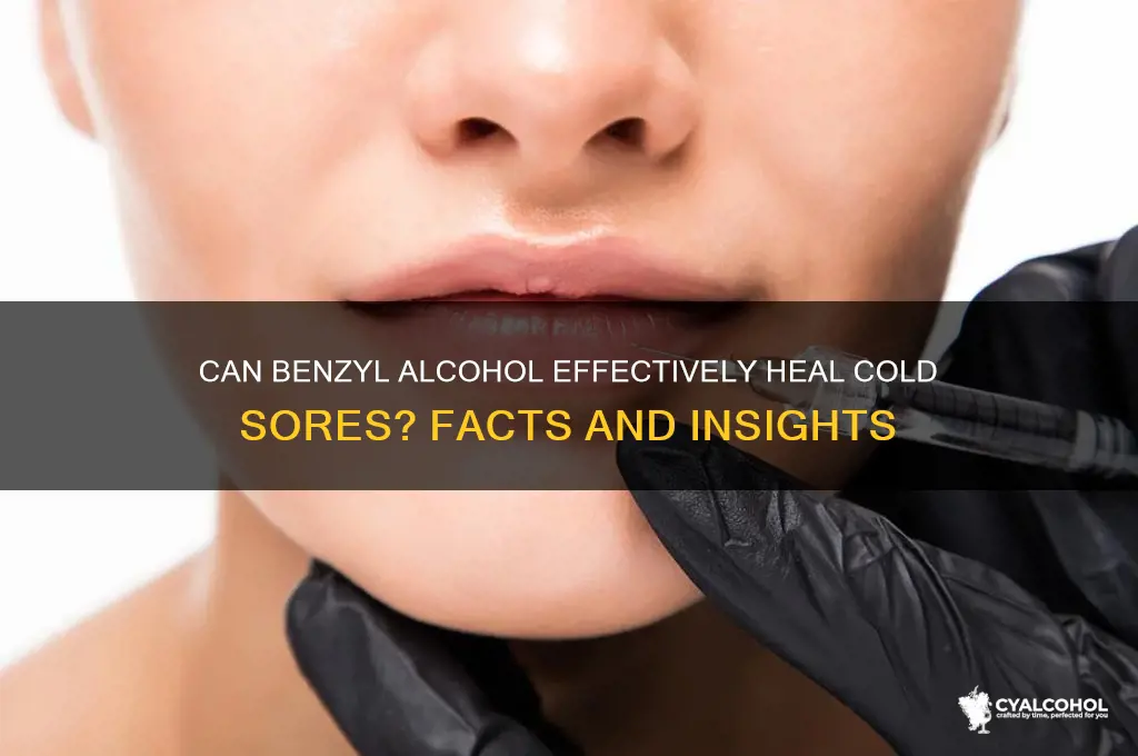 does benzyl alcohol heal cold sores