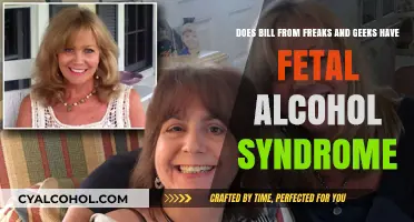 Bill from Freaks and Geeks: Fetal Alcohol Syndrome?