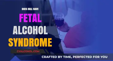 Does Bill Have Fetal Alcohol Syndrome? Exploring Symptoms and Diagnosis