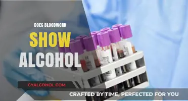Can Blood Tests Detect Alcohol Consumption? Facts and Insights