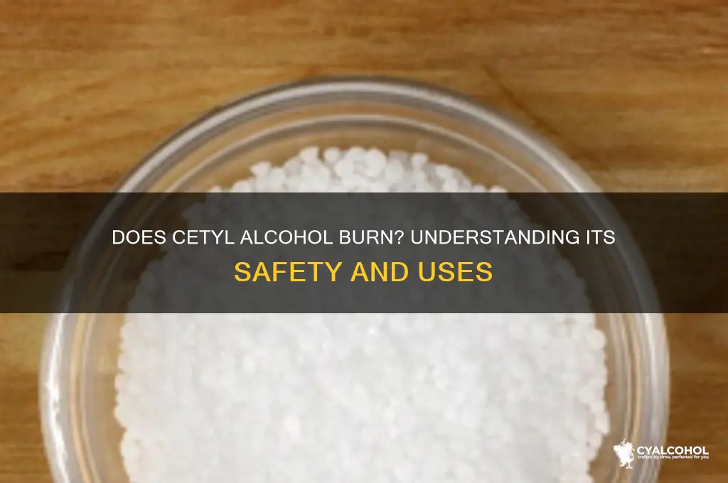 does cetyl alcohol burn