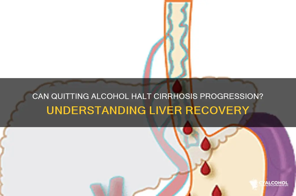 does cirrhosis progress after alcohol cessation