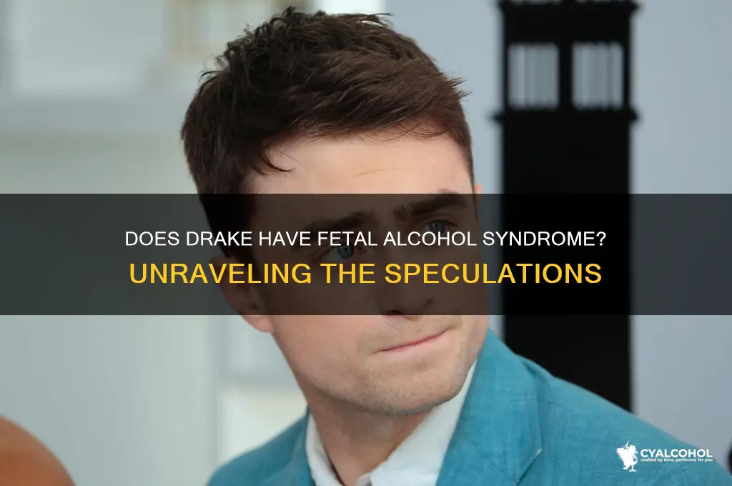 does drake have fetal alcohol syndrom