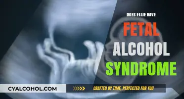 Does Ellie Have Fetal Alcohol Syndrome? Exploring the Signs and Symptoms