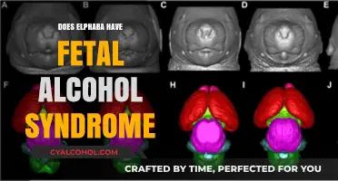 Exploring Elphaba's Traits: Fetal Alcohol Syndrome Speculations and Analysis