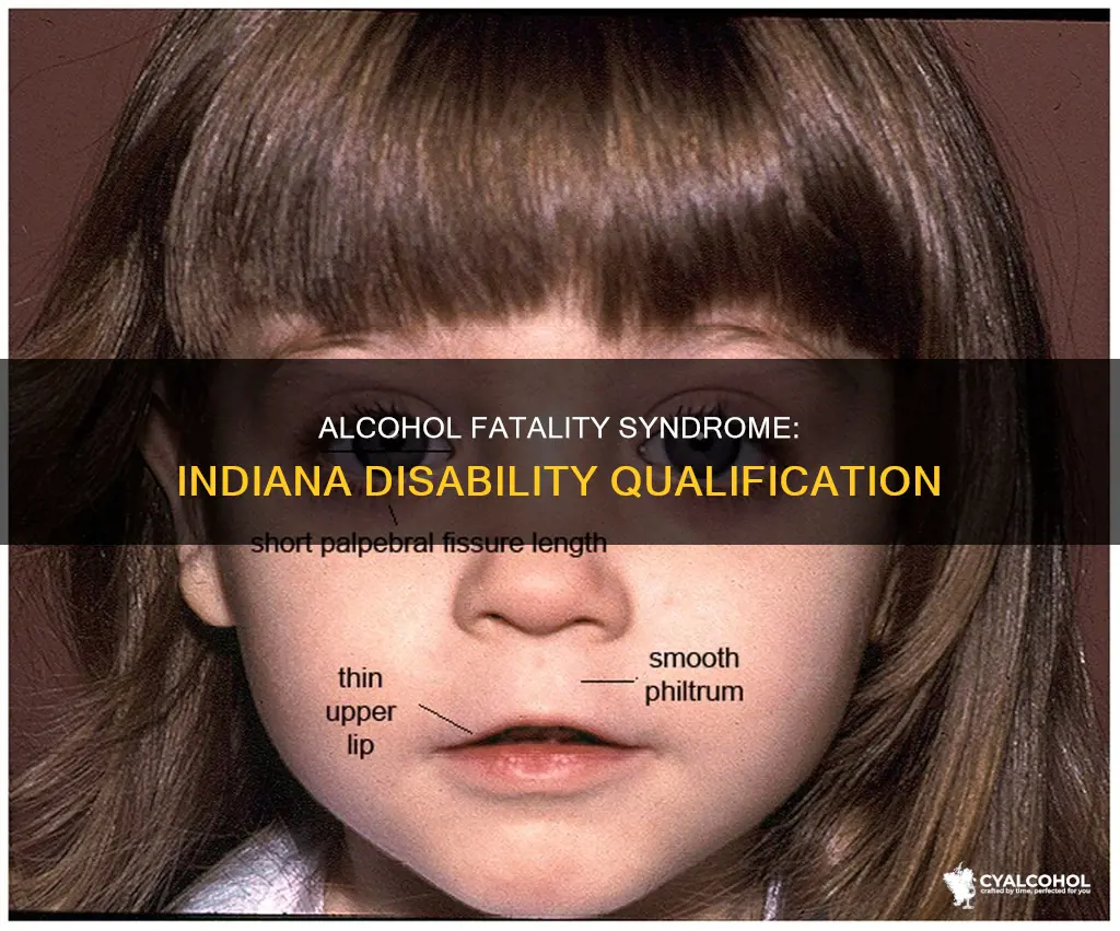 does fatal alcohol syndrome qualify for disability in indiana