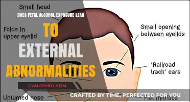 Fetal Alcohol Exposure: Uncovering Links to External Abnormalities