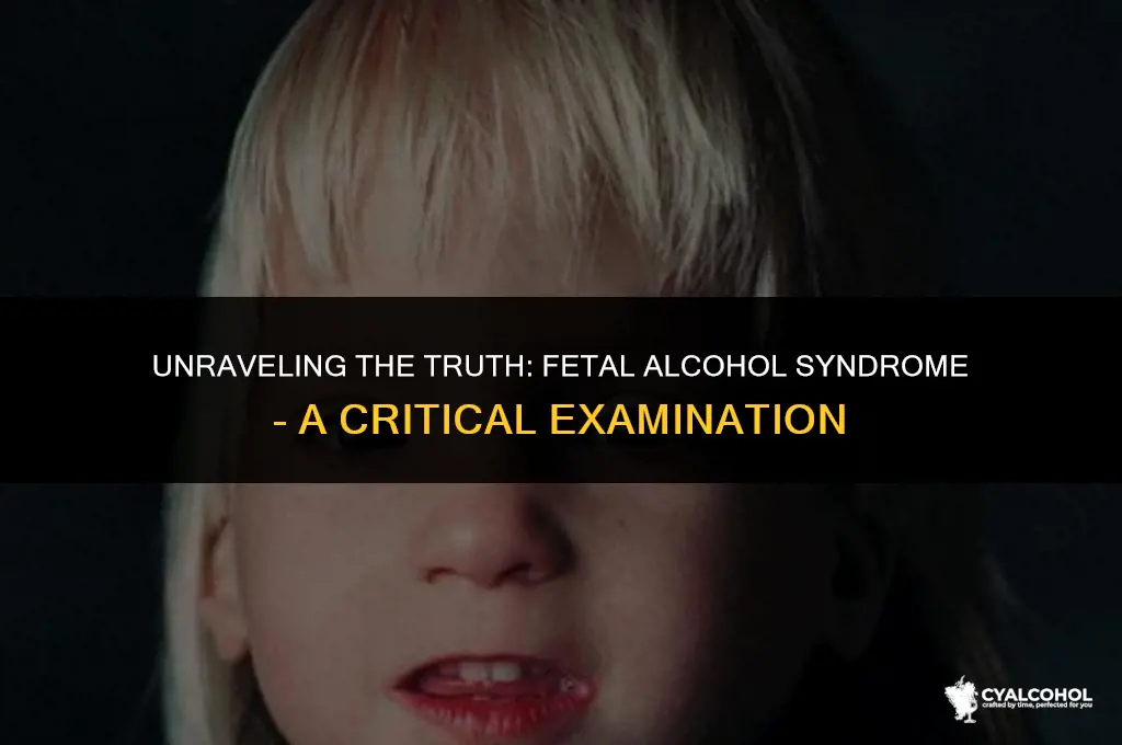 does fetal alcohol syndrome exist