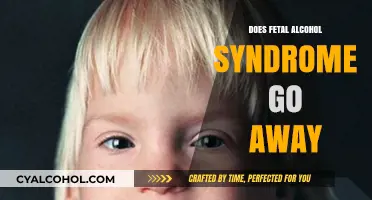 Does Fetal Alcohol Syndrome Go Away? Understanding Lifelong Impacts and Support