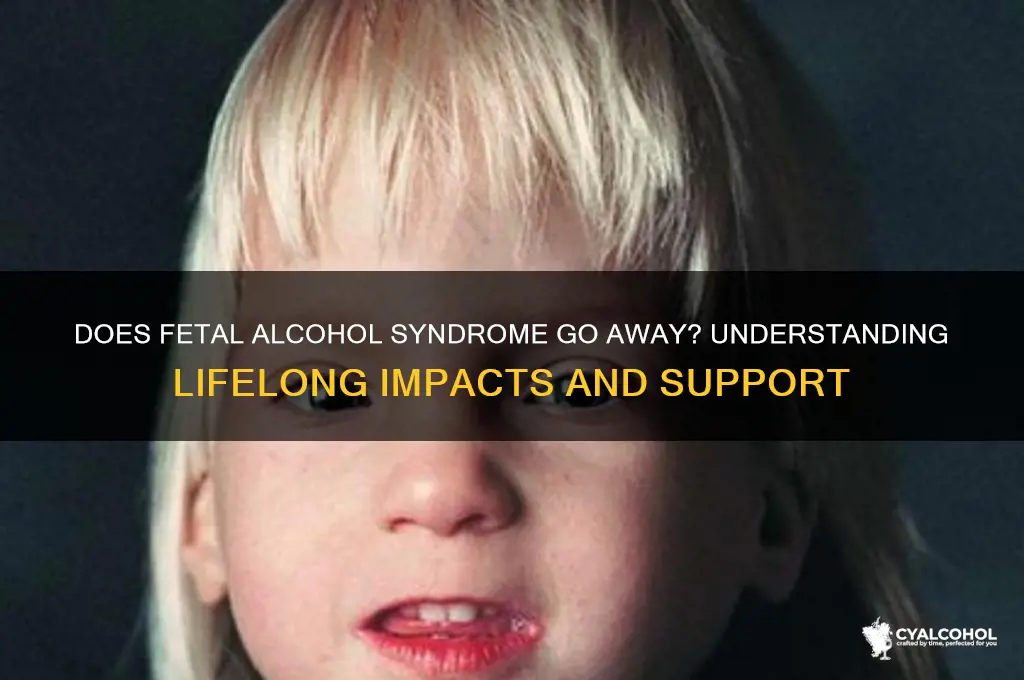 does fetal alcohol syndrome go away