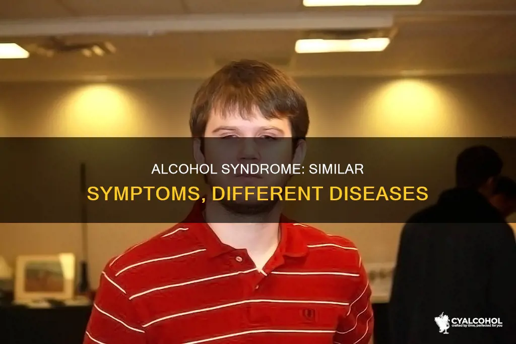 does fetal alcohol syndrome share symptoms with other diseases