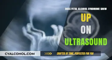 Can Ultrasounds Detect Fetal Alcohol Syndrome? What Parents Need to Know