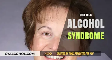 Understanding Fetal Alcohol Syndrome: Causes, Effects, and Prevention Strategies