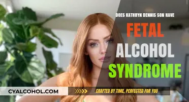 Kathryn Dennis' Son: Fetal Alcohol Syndrome Concerns Explored