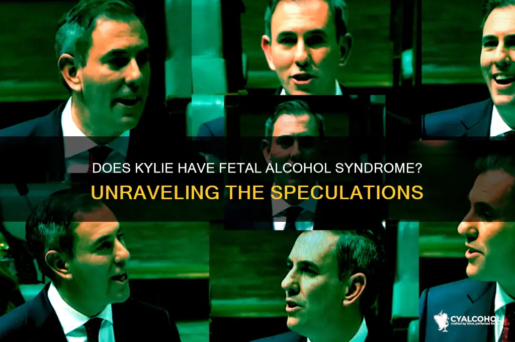 does kylie have fetal alcohol syndrome