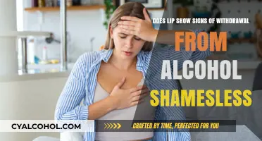 Alcohol Withdrawal: Lip Signs and Symptoms
