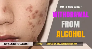 Can Your Lips Reveal Alcohol Withdrawal Symptoms? Signs to Watch For
