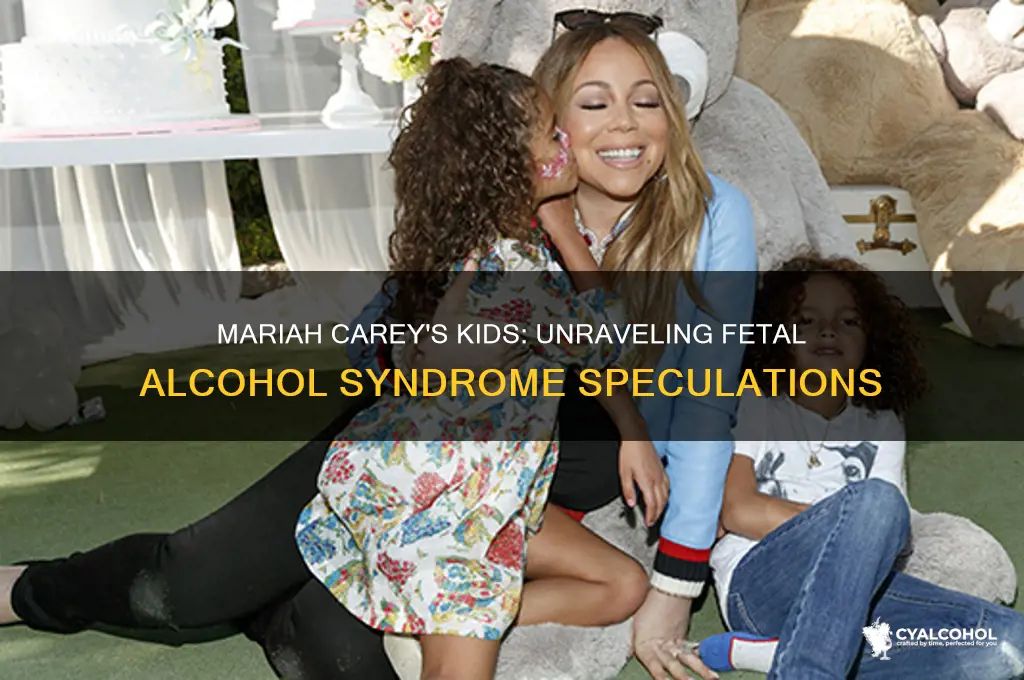 does mariah carey kids have fetal alcohol syndrome