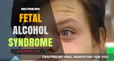 Exploring Claims: Does Putin Have Fetal Alcohol Syndrome?