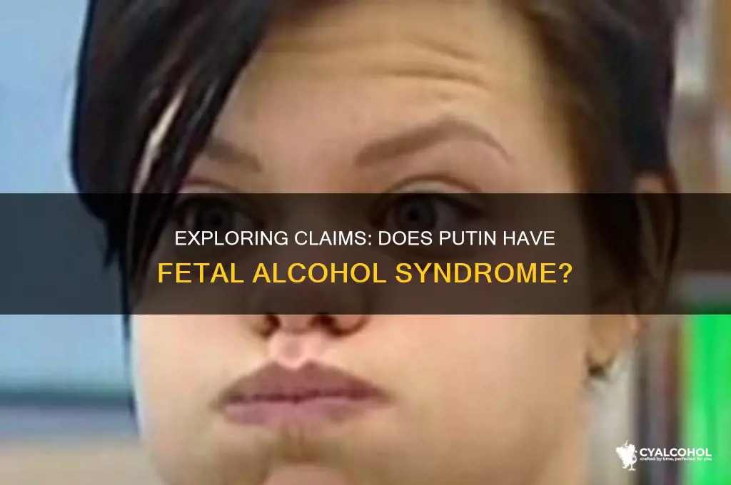 does putin have fetal alcohol syndrome