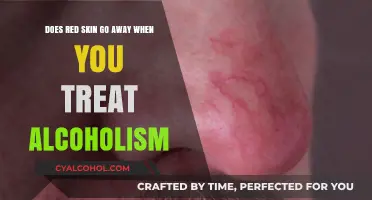 Alcoholism Treatment: Red Skin Relief