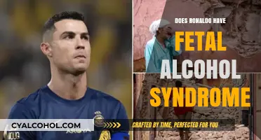 Does Ronaldo Have Fetal Alcohol Syndrome? Separating Fact from Fiction