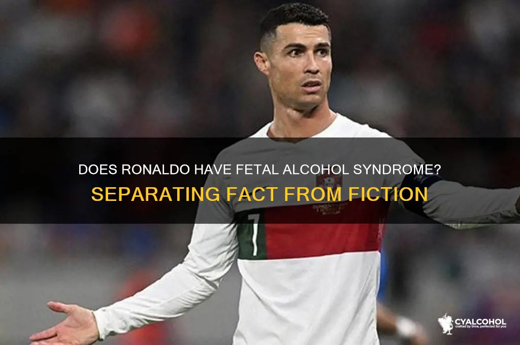 does ronaldo have fetal alcohol syndrome