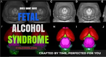 Does Saint Have Fetal Alcohol Syndrome? Unraveling the Speculations