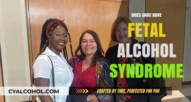 Exploring the Myth: Can Shoes Develop Fetal Alcohol Syndrome?