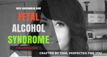 Exploring Claims: Does Shoeonhead Have Fetal Alcohol Syndrome?
