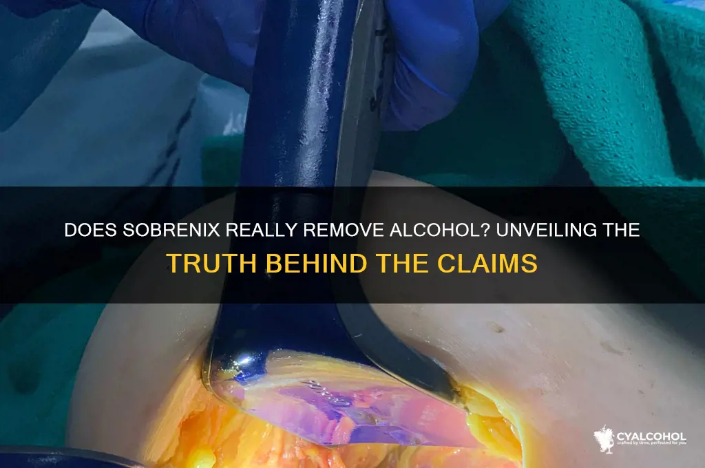 does sobrenix remove alcohol