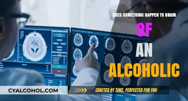 Alcohol's Impact: Unraveling the Brain Changes in Alcoholism