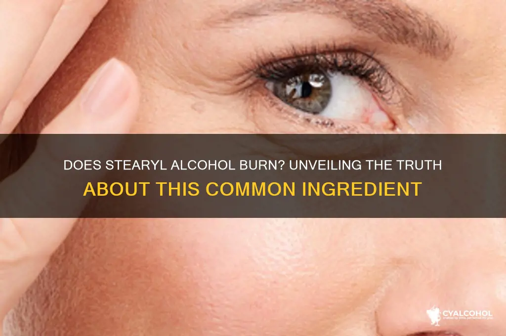 does stearyl alcohol burn