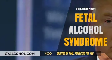 Exploring Claims: Does Trump Exhibit Fetal Alcohol Syndrome Traits?